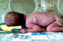 Inkubaattori äidin sijaan: miksi tutkijat luovat keinotekoisen kohdun